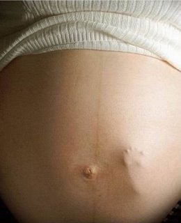Grávida de anencéfalo desiste de abortar